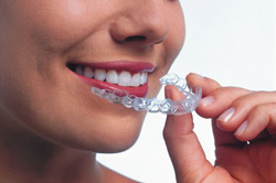 invisalign